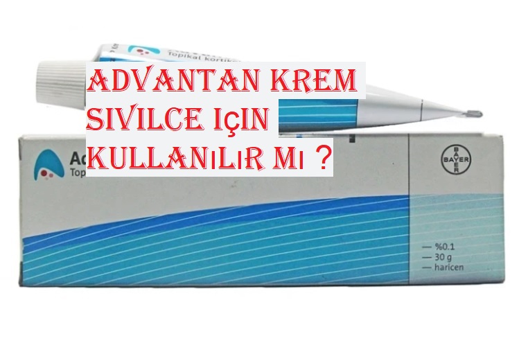 Advantan krem sivilce için kullanılır mı ?