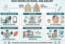 nad eksikliği nasıl anlaşılır