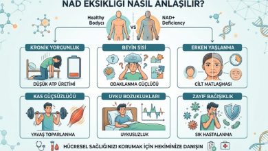 nad eksikliği nasıl anlaşılır