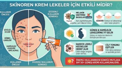 skinören krem lekelere iyi gelir mi