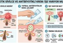 sivilce için antibiyotikli krem işe yarıyor mu