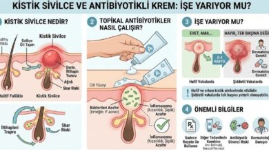 sivilce için antibiyotikli krem işe yarıyor mu